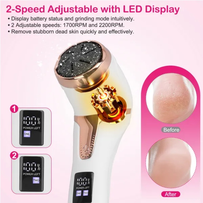17Pcs Electric Foot Callus Remover - Image 3